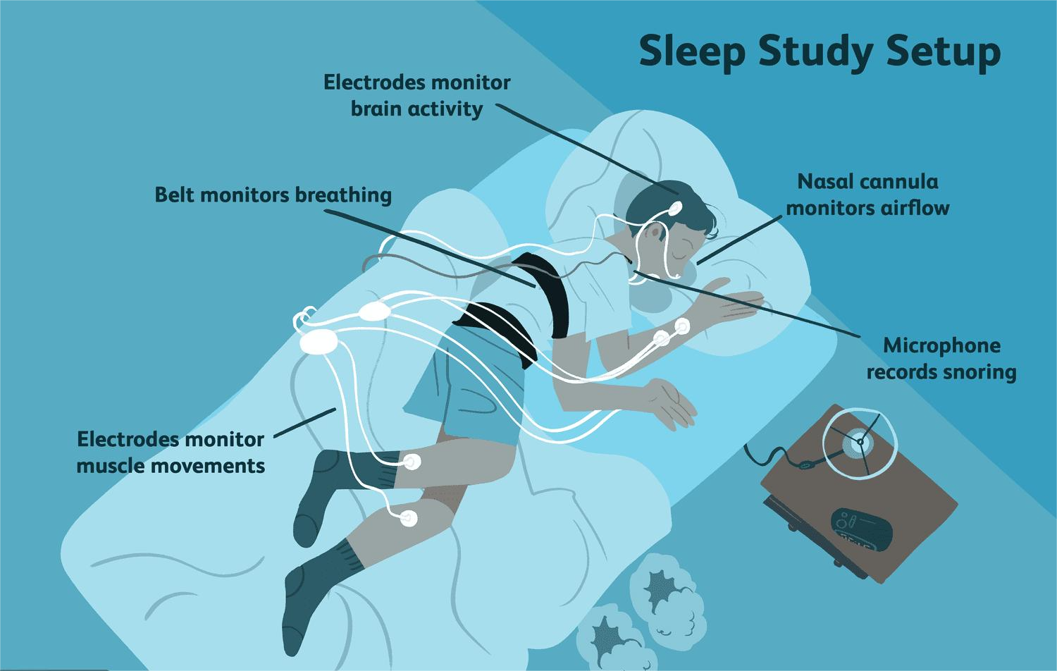 Sleep Study